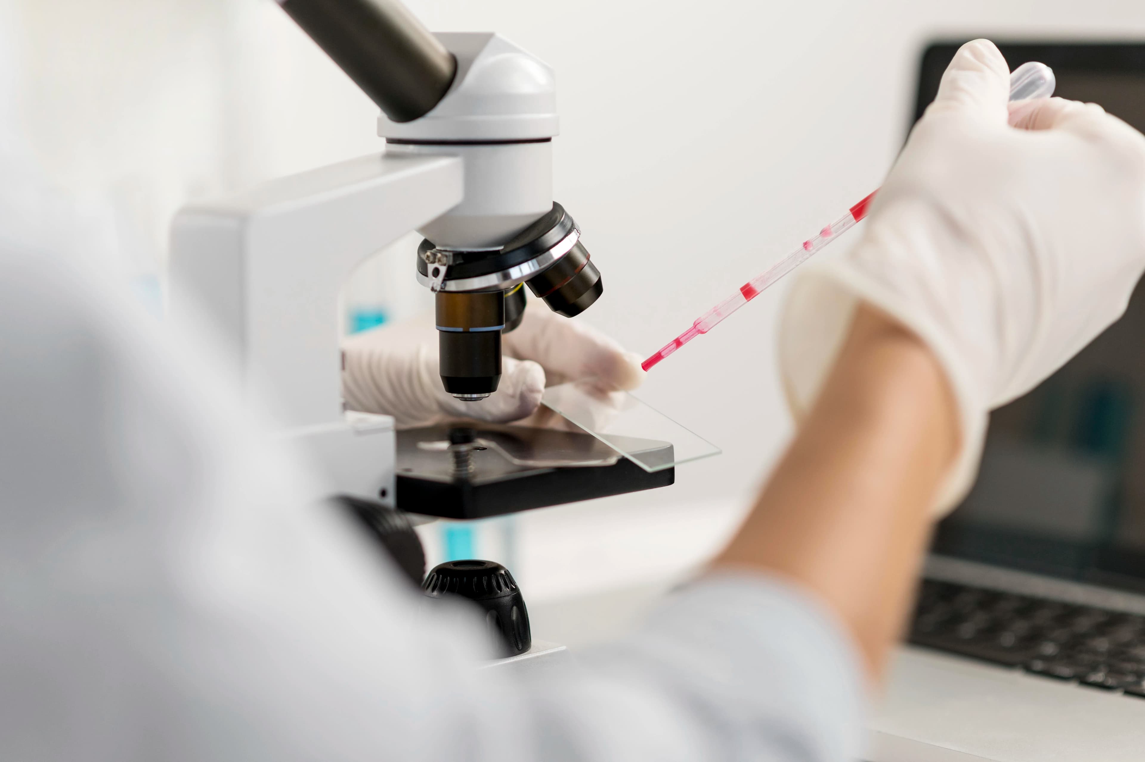 Lab Claims Management